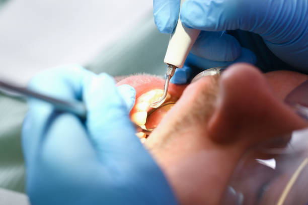 Best Dentist Open Late Near Me  in Rosemont, CA