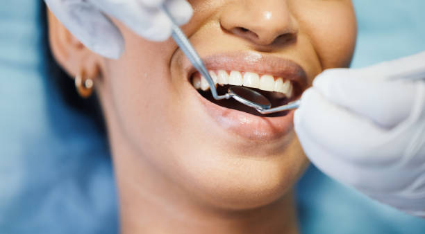 Best Urgent Tooth Repair  in Rosemont, CA