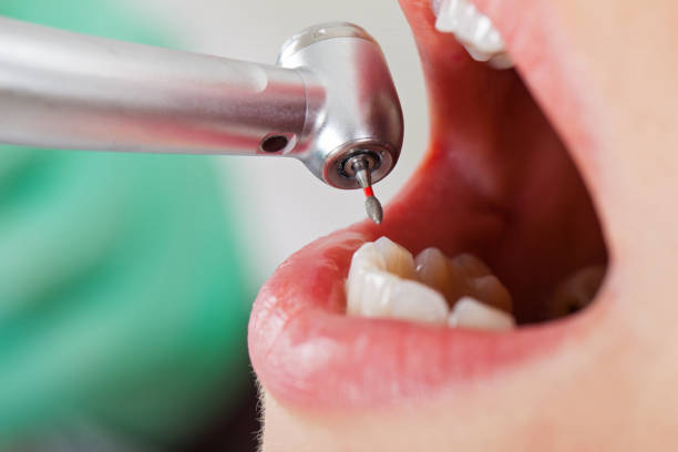 Best Emergency Dentist Near Me  in Rosemont, CA